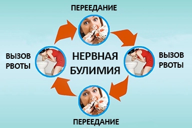 Лечение булимии в Заречном